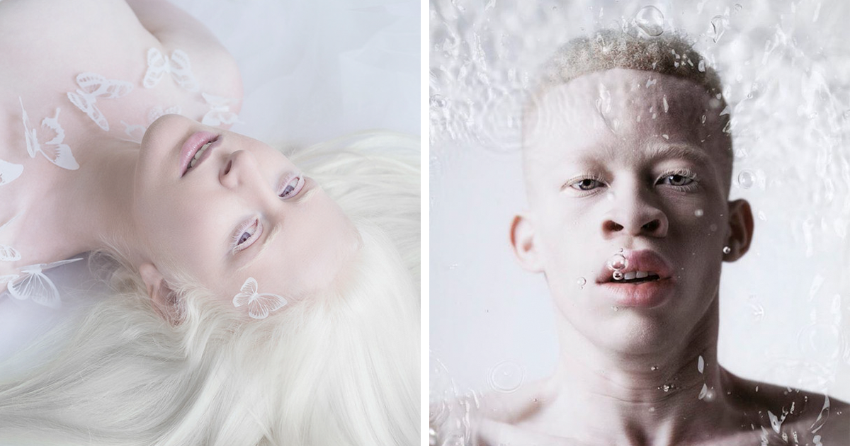 beautiful-albino-people-albinism-fb