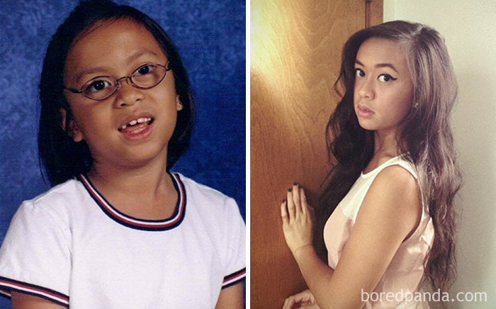 before-after-ugly-duckling-beauty-transformation-02