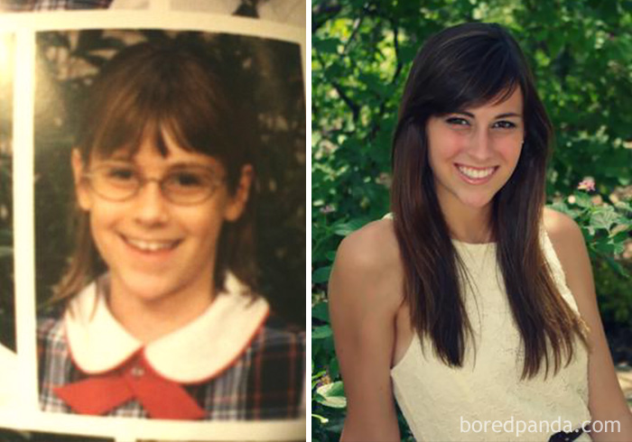 before-after-ugly-duckling-beauty-transformation-7