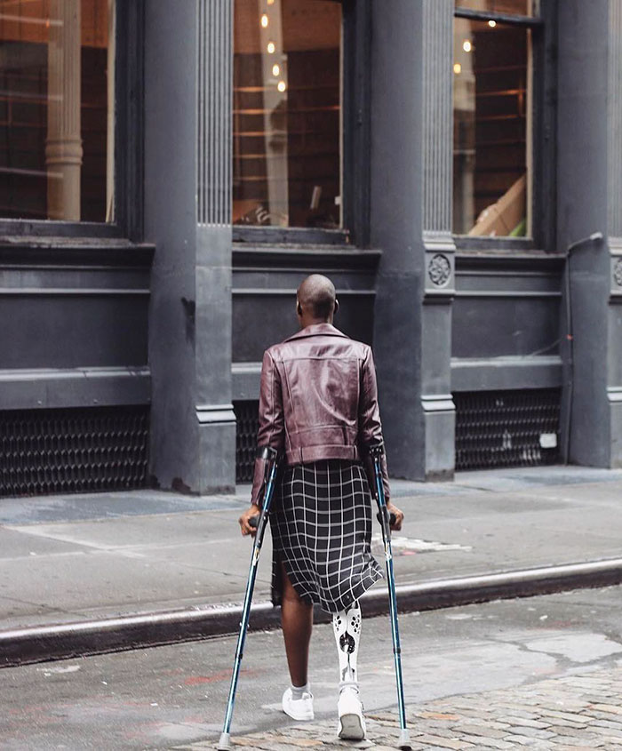 stylish-leg-prosthetics-alleles-studio-71