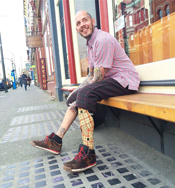 stylish-leg-prosthetics-alleles-studio-15