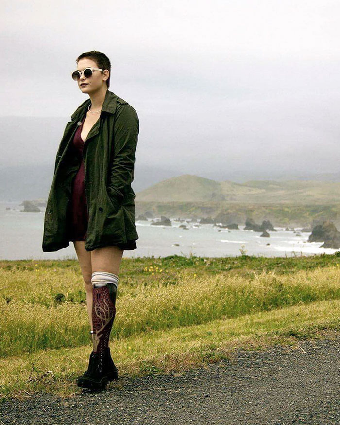 stylish-leg-prosthetics-alleles-studio-1