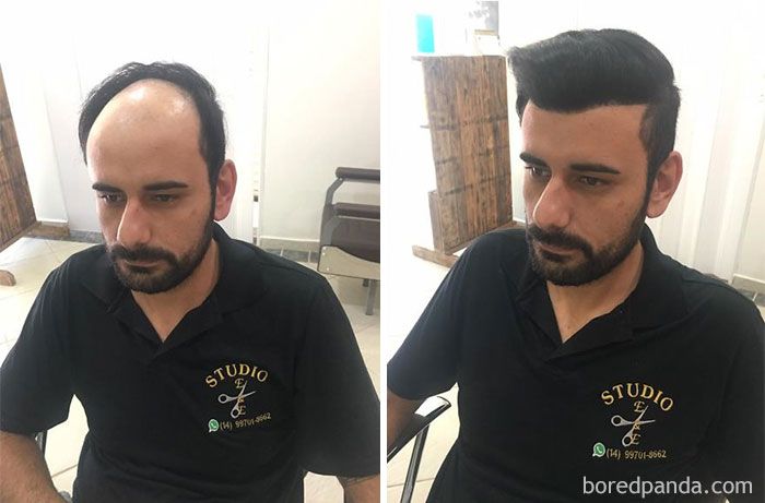 6ae6d6d0a7586604a12b87d2b2688f85_before-after-extreme-haircut-transformations-108-5966122931c26__700