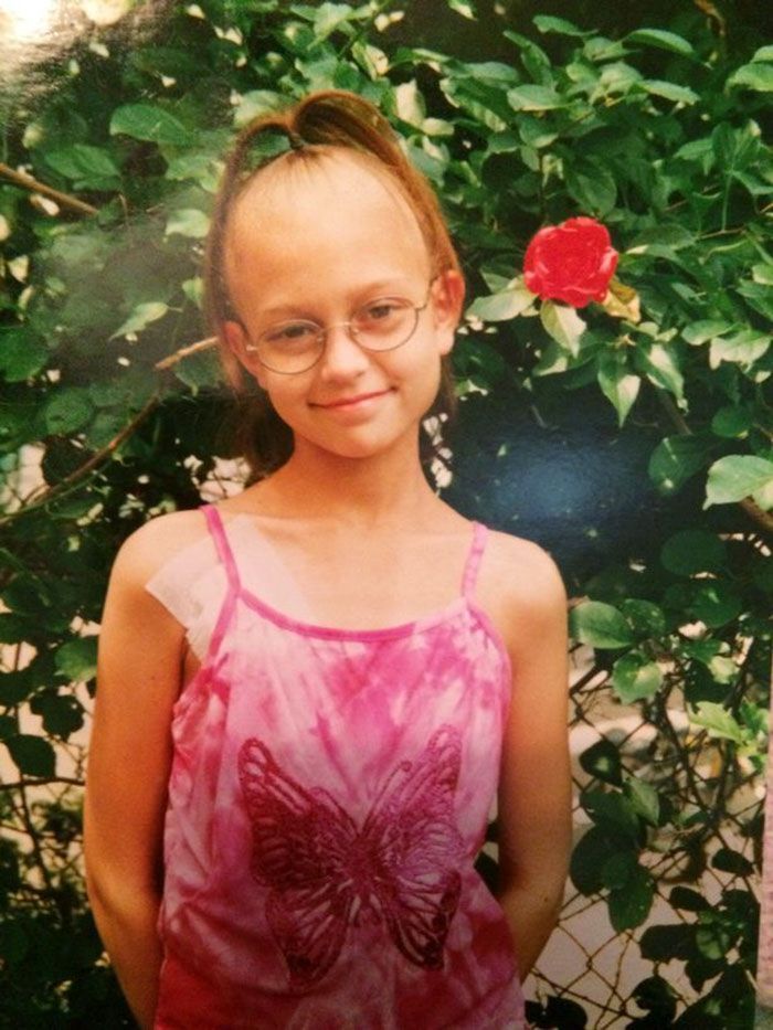 Quand cette fille s'est fait amputer la jambe à 11 ans, personne ne s'attendait à ce qu'elle devienne mannequin 20 ans plus tard. Quand cette fille s'est fait amputer la jambe à 11 ans, personne ne s'attendait à ce qu'elle devienne mannequin 20 ans plus tard.
