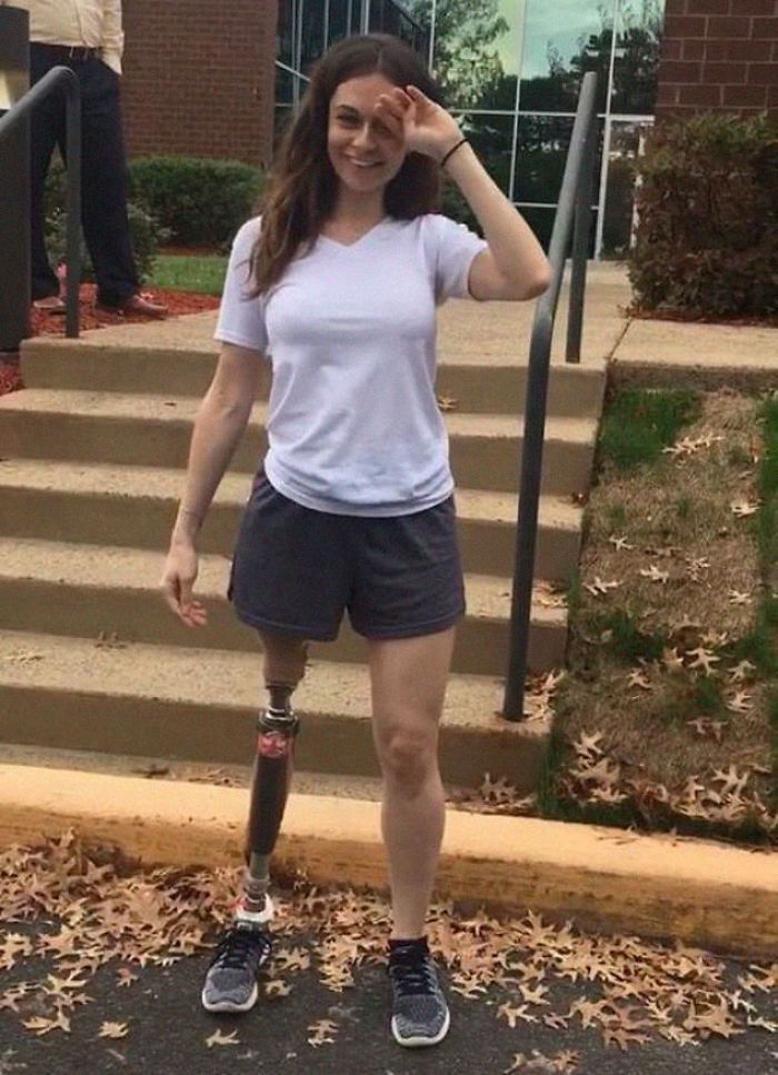 Quand cette fille s'est fait amputer la jambe à 11 ans, personne ne s'attendait à ce qu'elle devienne mannequin 20 ans plus tard. Quand cette fille s'est fait amputer la jambe à 11 ans, personne ne s'attendait à ce qu'elle devienne mannequin 20 ans plus tard.