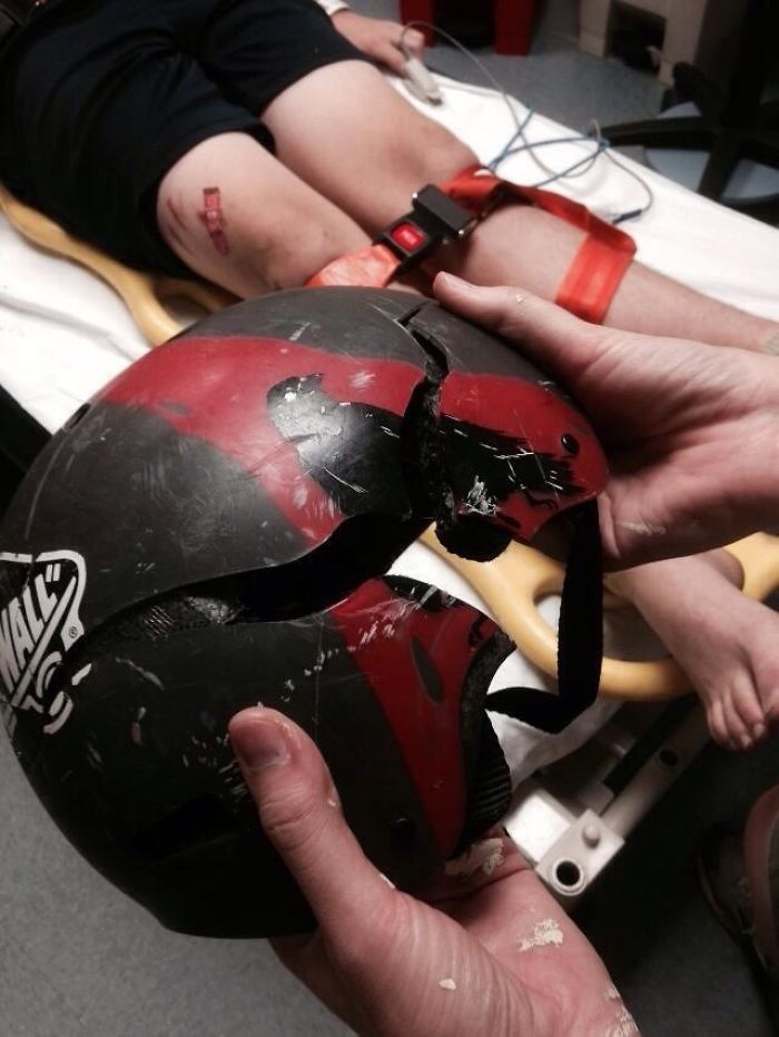 et ceci, les enfants, est la raison pour laquelle nous portons des casques quand nous faisons du skateboard