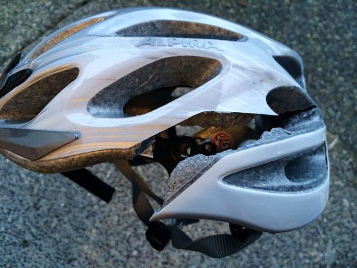 Mon ami a subi une commotion cérébrale après un accident de vélo. Son casque lui a sauvé la vie. Porte ton casque !