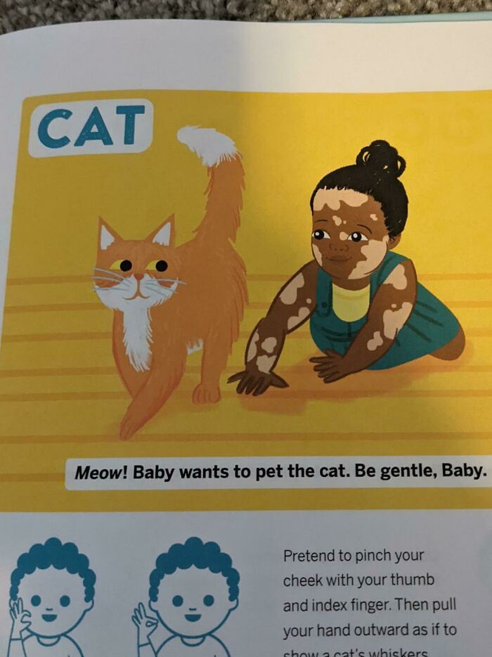 Ce livre utilise un dessin d’un bébé atteint de vitiligo.