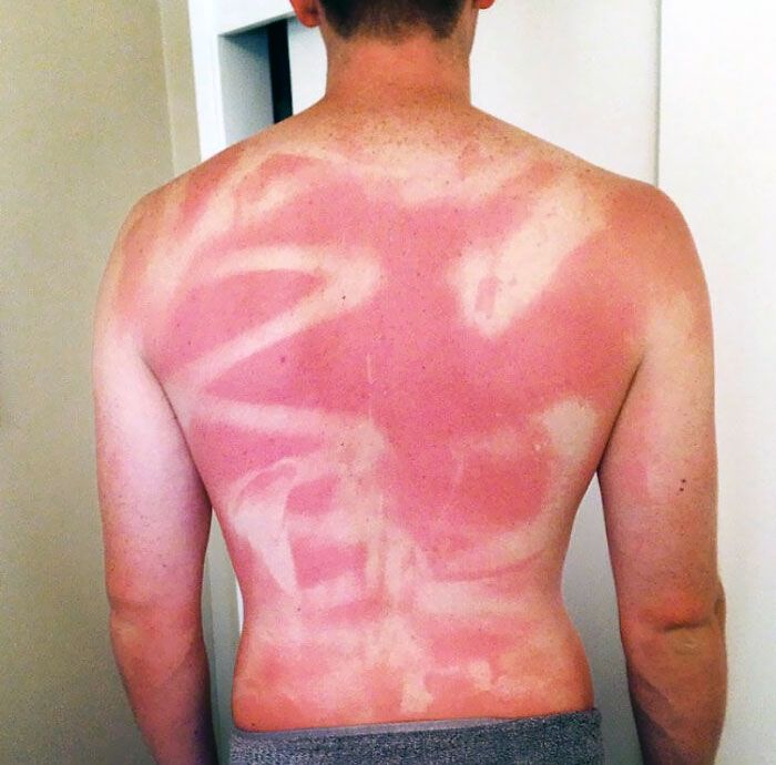 l’été dernier, lorsque ma femme a “pulvérisé” de la crème solaire sur tout mon dos