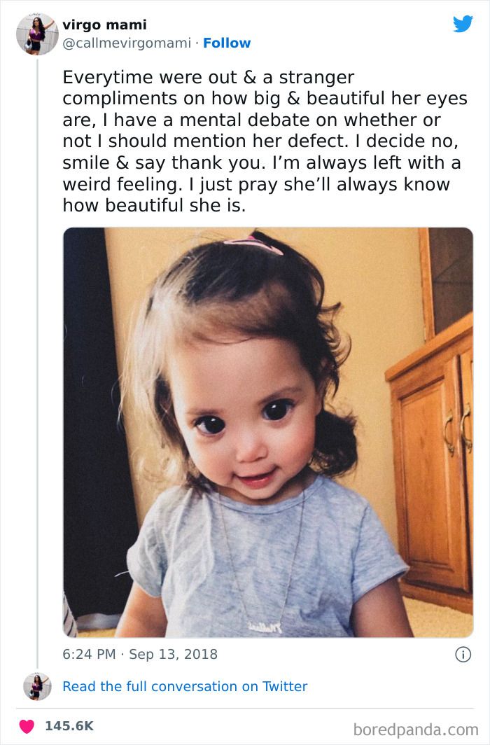 les grands et beaux yeux de cette petite fille sont dus à un syndrome génétique rare appelé syndrome d’axenfeld-rieger