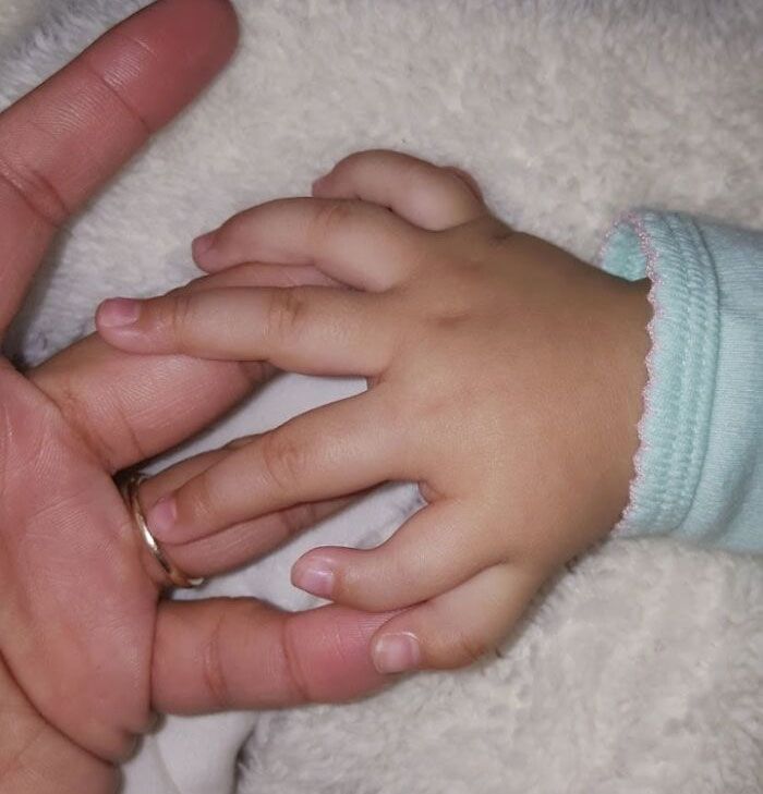ma petite sœur est née avec six doigts