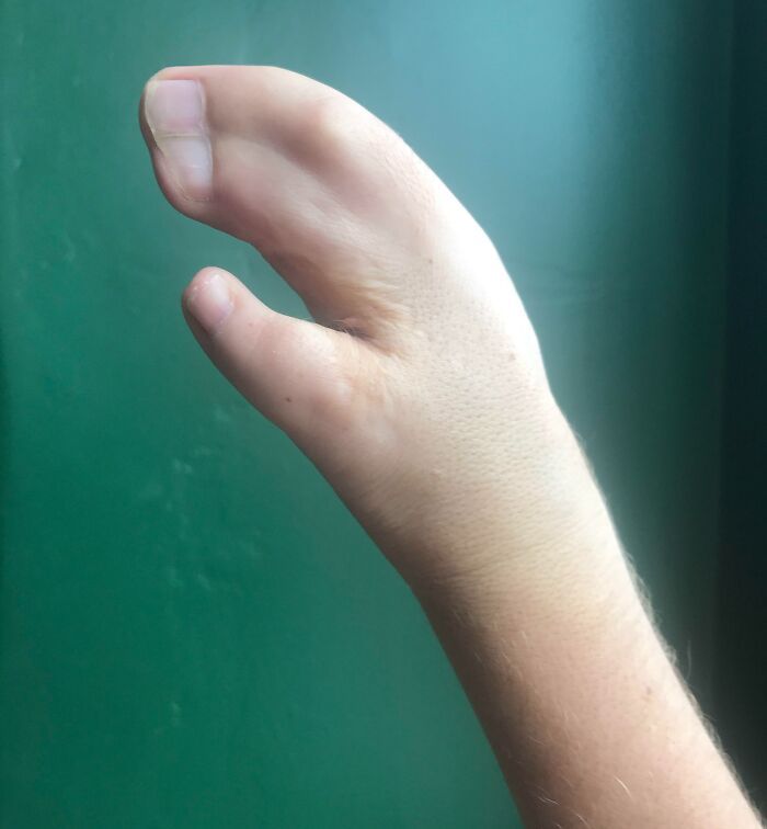Voici une photo de la main avec laquelle je suis née.