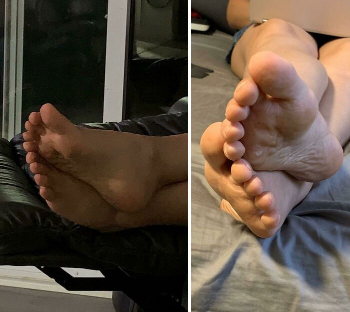 la façon dont les orteils de mon fiancé sont alignés