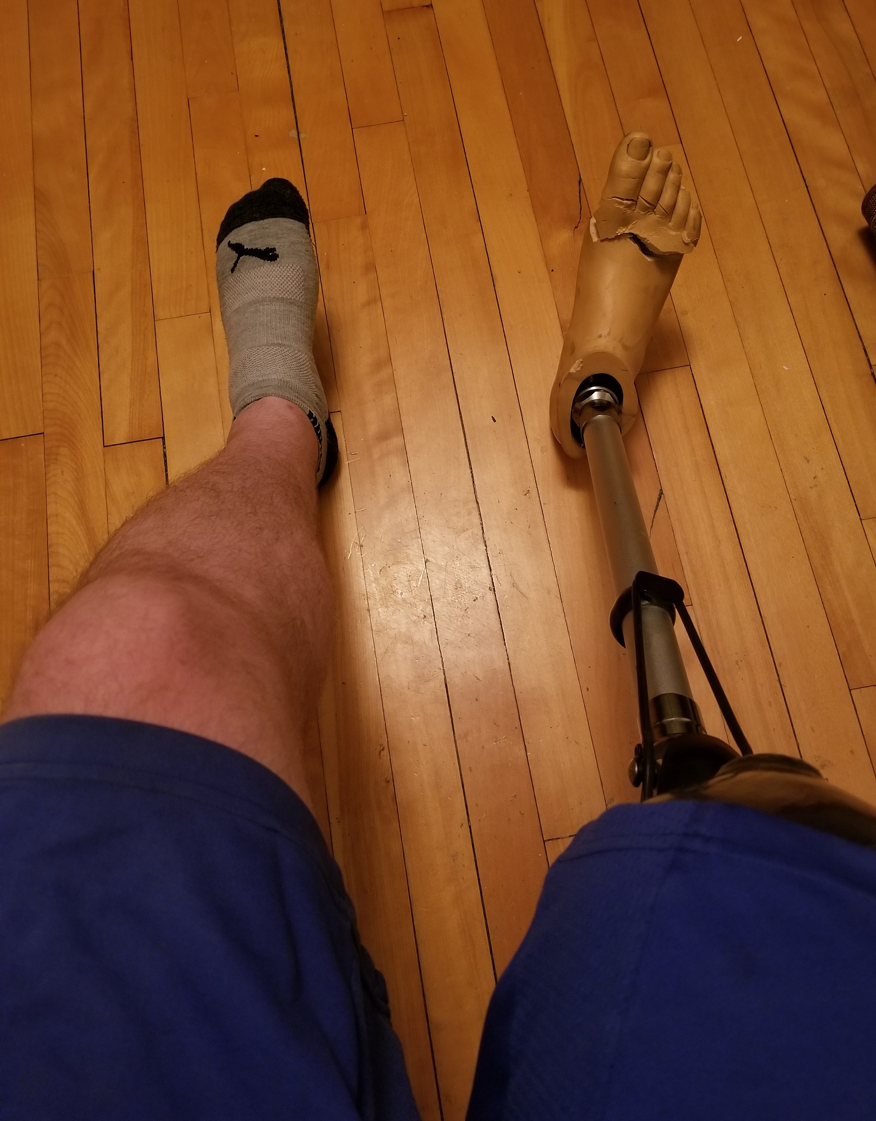 J'ai perdu les orteils de ma prothèse après que le chien de mon ami a pensé que le pied était un jouet à mâcher.