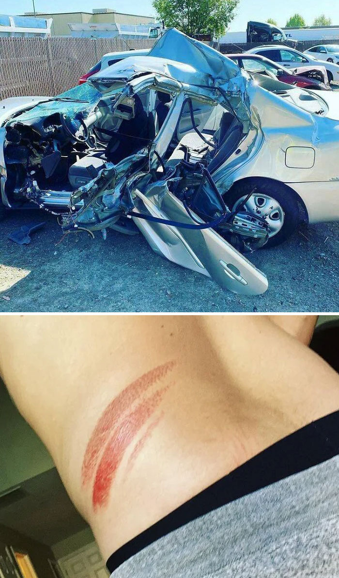 C’est la voiture de mon ami après qu’il ait été heurté par un semi. L’image suivante est la seule blessure qu’il a subie.