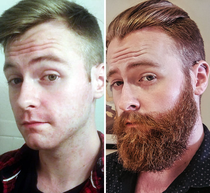 barbe ou pas barbe