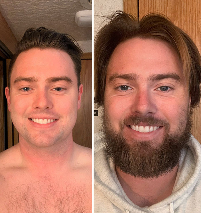 Voici mes progrès depuis 5 mois. J’adore ma barbe et mes cheveux.