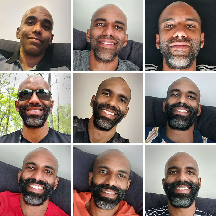 L’évolution de la barbe. 8 semaines après le rasage