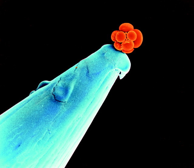 Un embryon humain précoce sur la pointe d’une aiguille