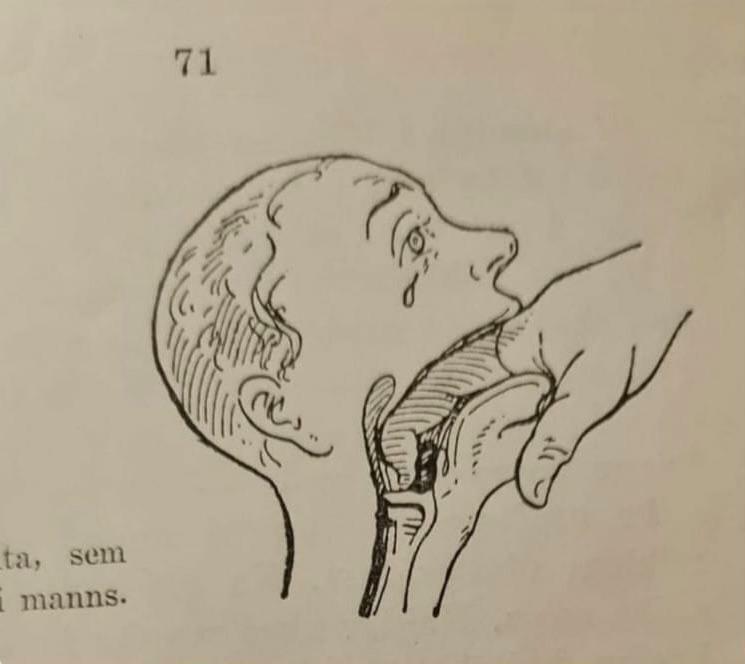 Manuel de premiers secours de ce qu’il faut faire quand quelqu’un s’étouffe